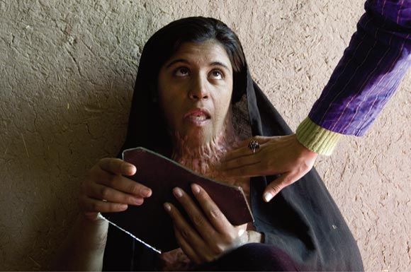 Afghan woman with burns on neck looks at herself in broken mirror