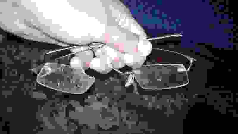 Ankit Lal's spectacles broken in assault