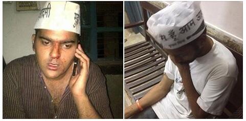 Nandan and Ankit Lal injured by BJP thugs