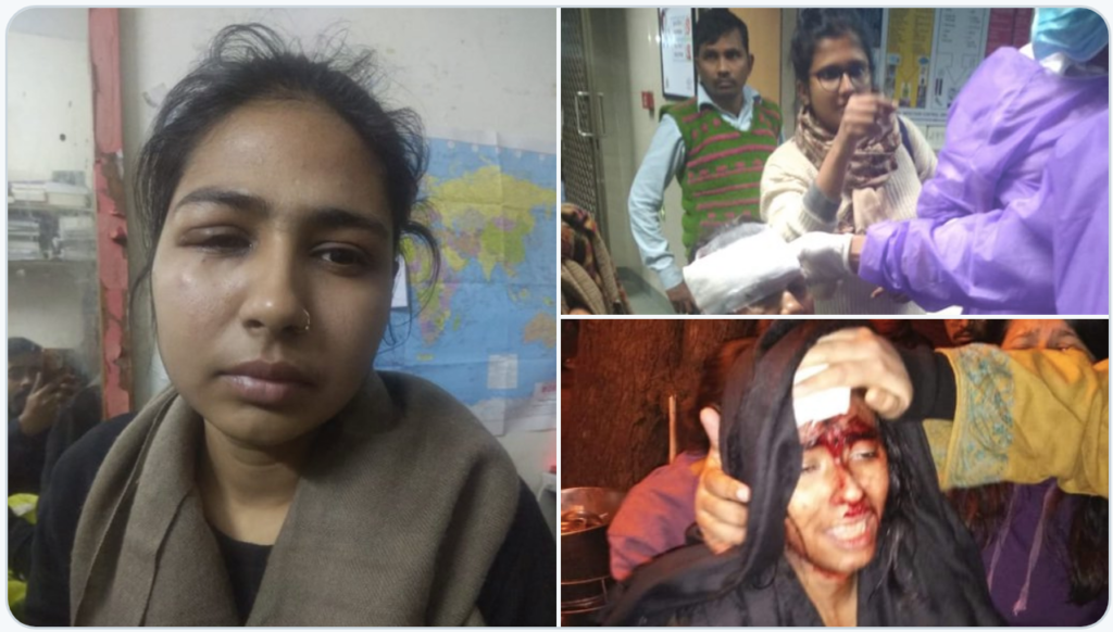 injured students and faculty at JNU